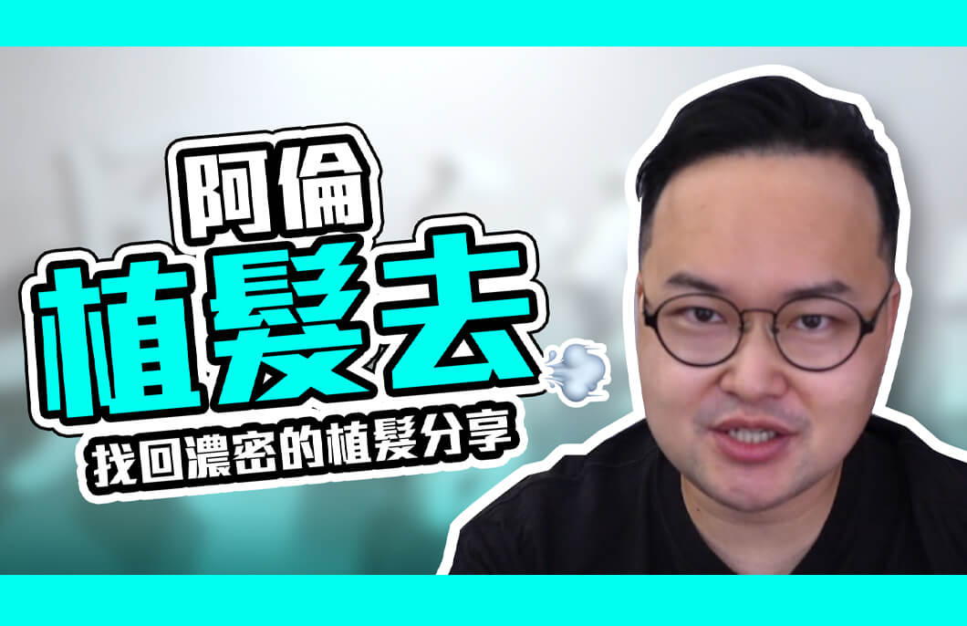 【植髮】阿倫植髮去!擺脫中年危機，找回濃密的植髮分享