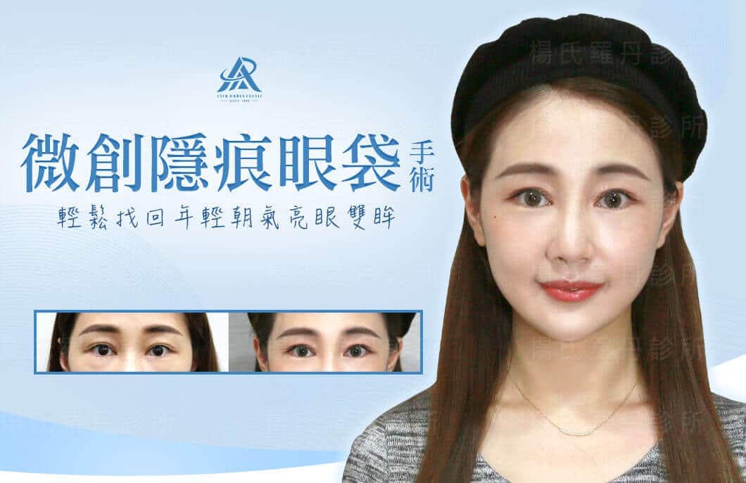 【眼袋淚溝】微創隱痕眼袋手術，輕鬆找回年輕朝氣亮眼雙眸