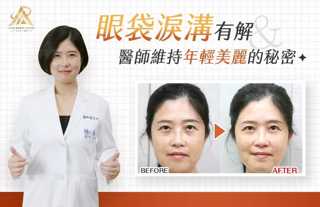 【眼袋淚溝】眼袋淚溝有解，醫師維持年輕美麗的秘密！