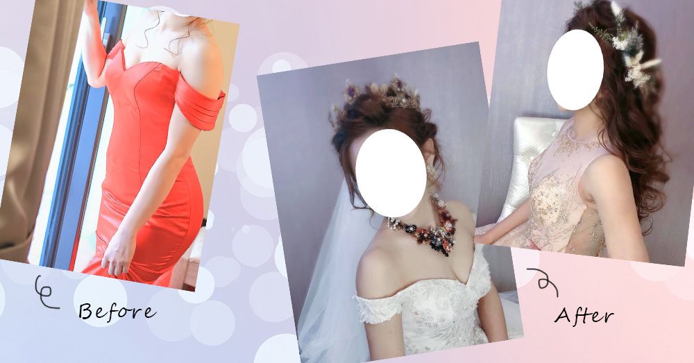 台中雷射減脂瘦手臂和消除副乳(賴斯敏醫師)