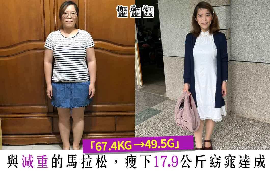 【減肥減重】更加窈窕美麗自信 減重17.9公斤瘦身成功