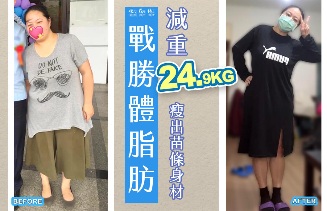 【減肥減重】戰勝體脂肪，減重24.9公斤瘦出苗條身材！