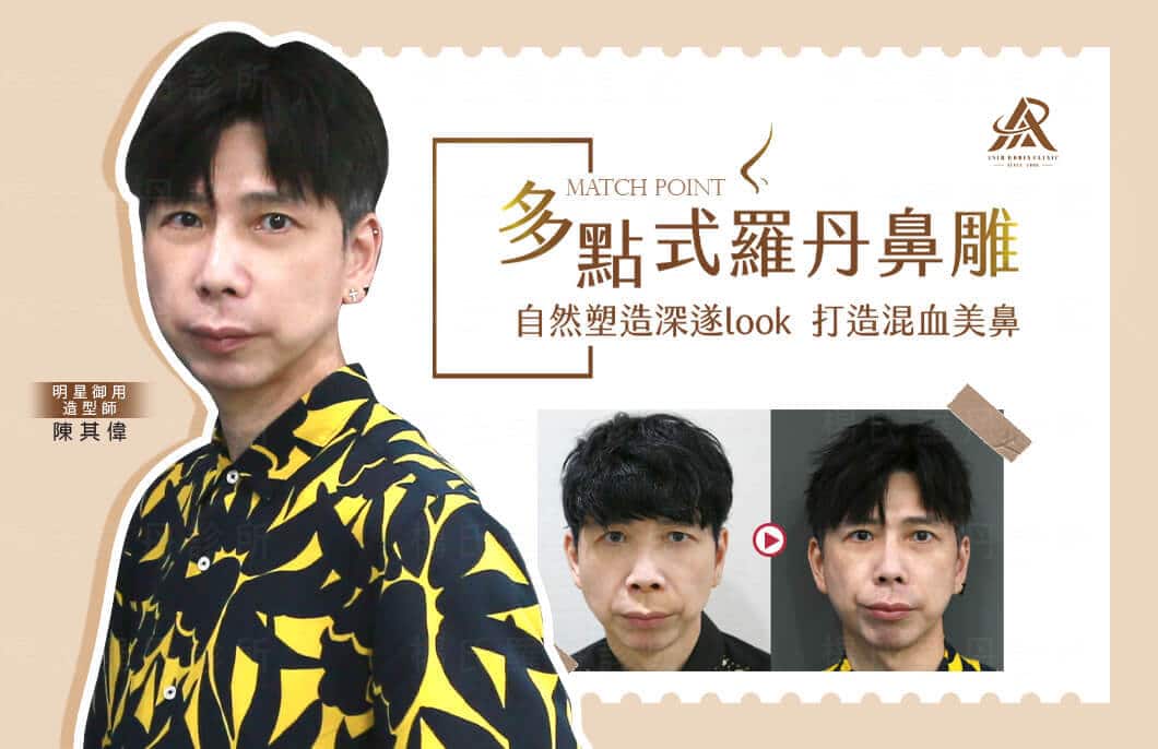 【鼻型調整】多點式羅丹鼻雕，自然塑造深遂的混血挺鼻!