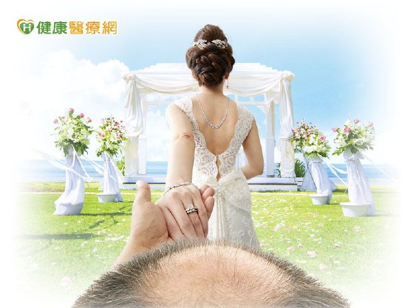 十禿九富？人生勝利組慘遭髮際線KO