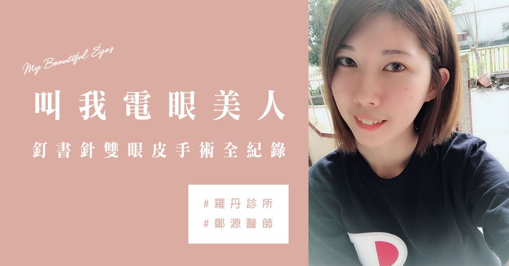 【新竹‧訂書針(釘書機)雙眼皮手術】打造美瞳紀錄~鬆垂眼皮變外雙大眼囉！