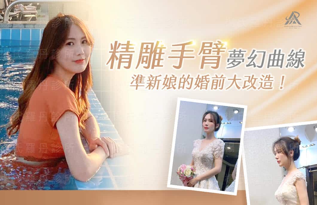 【雷射減脂】精雕手臂夢幻曲線，準新娘的婚前大改造！