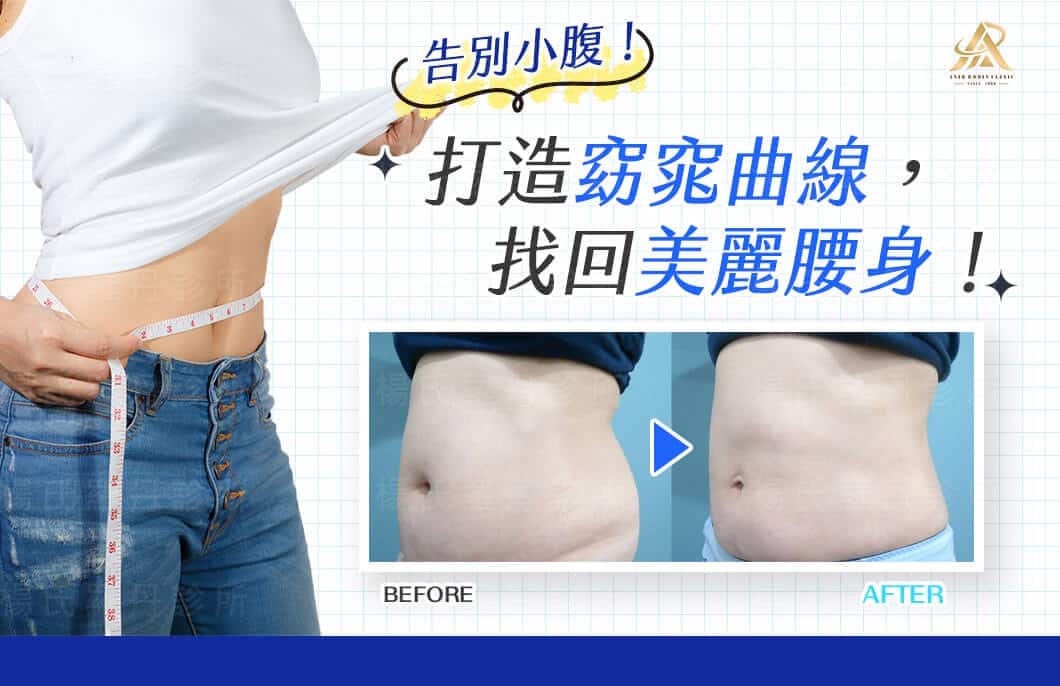 【雷射減脂】告別小腹！打造窈窕曲線，找回美麗腰身！