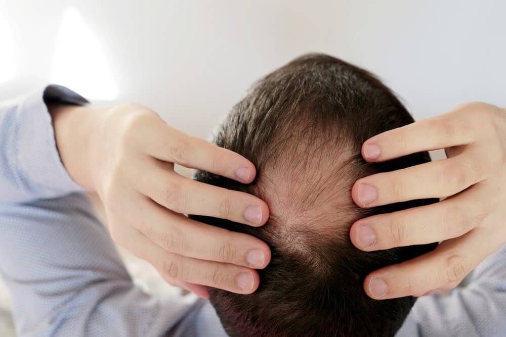 【生髮全攻略】5分鐘了解生髮方法與療程，改善頭髮稀疏找回自信