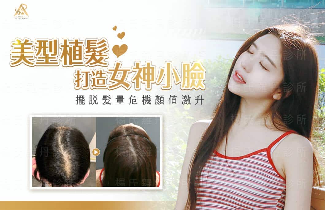 【植髮】美型植髮增髮量，造型蓬鬆顯小臉，女神安琪的微創植髮！