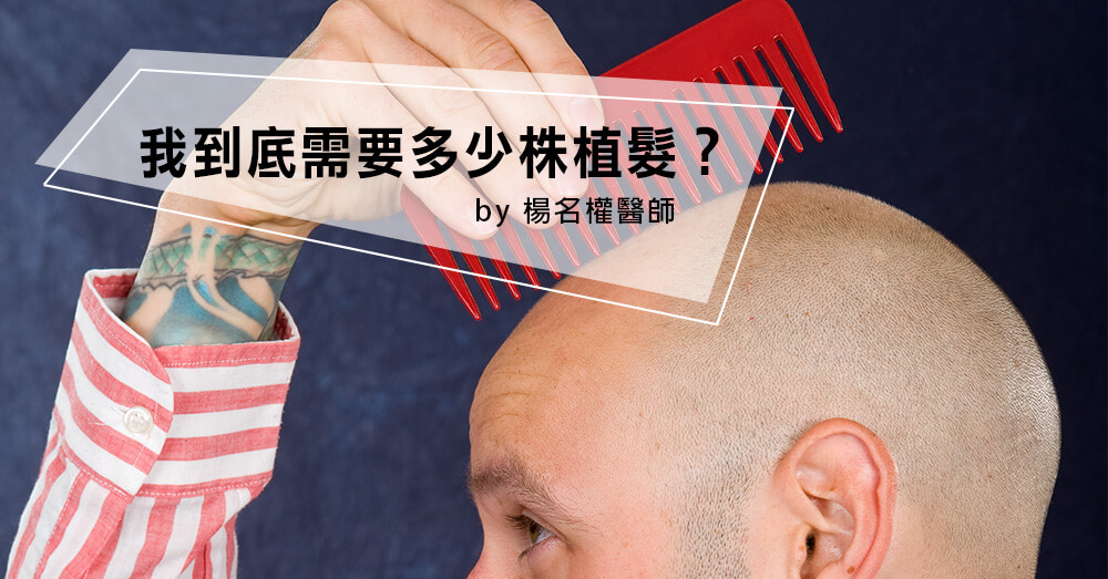 我到底需要多少株植髮？