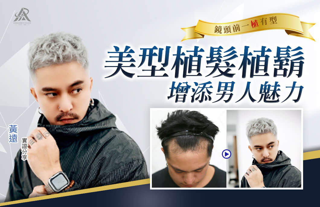【植髮】黃遠的美型植髮植鬍，增添男人魅力，鏡頭前一植有型