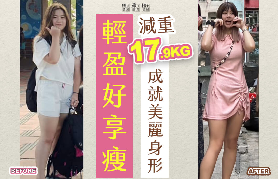 【減肥減重】輕盈好享瘦，減重17.9公斤成就美麗身形