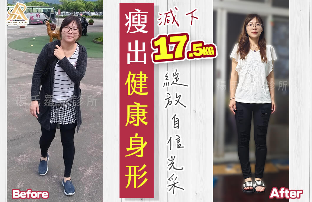 【減肥減重】瘦出健康身形，減下17.5公斤綻放自信光采