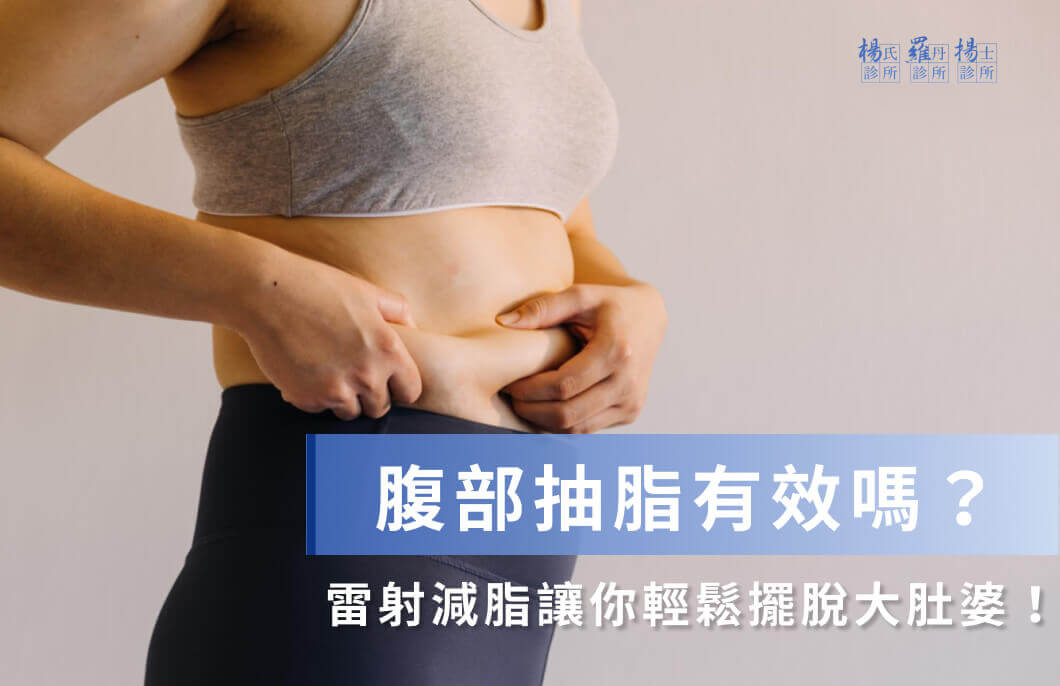 腹部抽脂有效嗎？雷射減脂讓你輕鬆擺脫大肚婆！