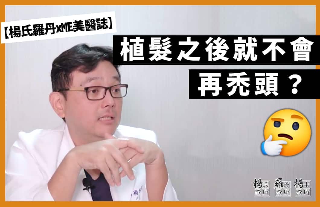 【楊氏羅丹xME美醫誌】植髮後一勞永逸？供髮區與甜蜜區是什麼？