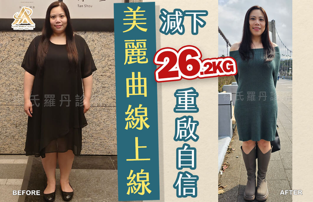 【減肥減重】美麗曲線上線，減下26.2公斤重啟自信