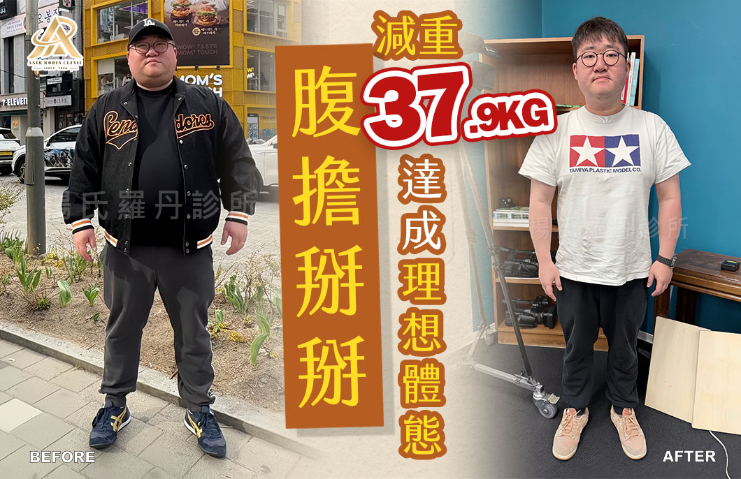 【減肥減重】腹擔掰掰，減重37.9公斤達成理想體態