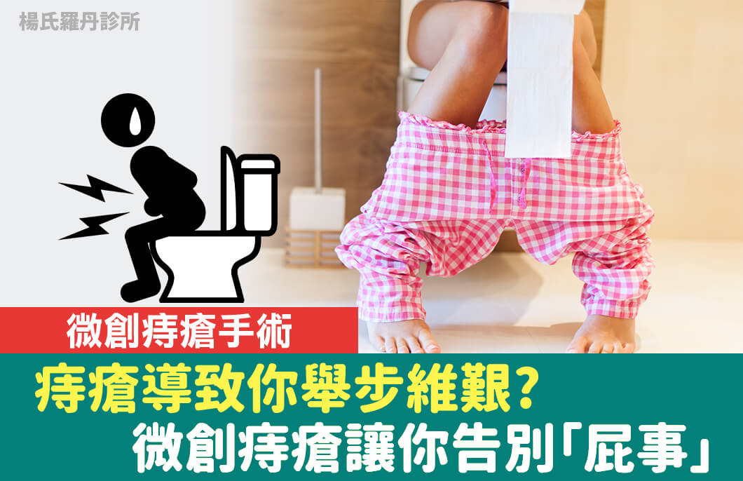 【痔瘡手術】痔瘡導致你舉步維艱?微創痔瘡讓你告別「屁事」