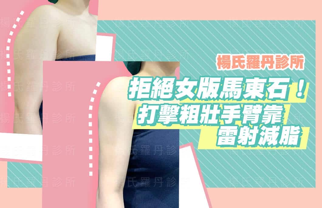 【雷射減脂】拒絕女版馬東石！打擊粗壯手臂靠雷射減脂
