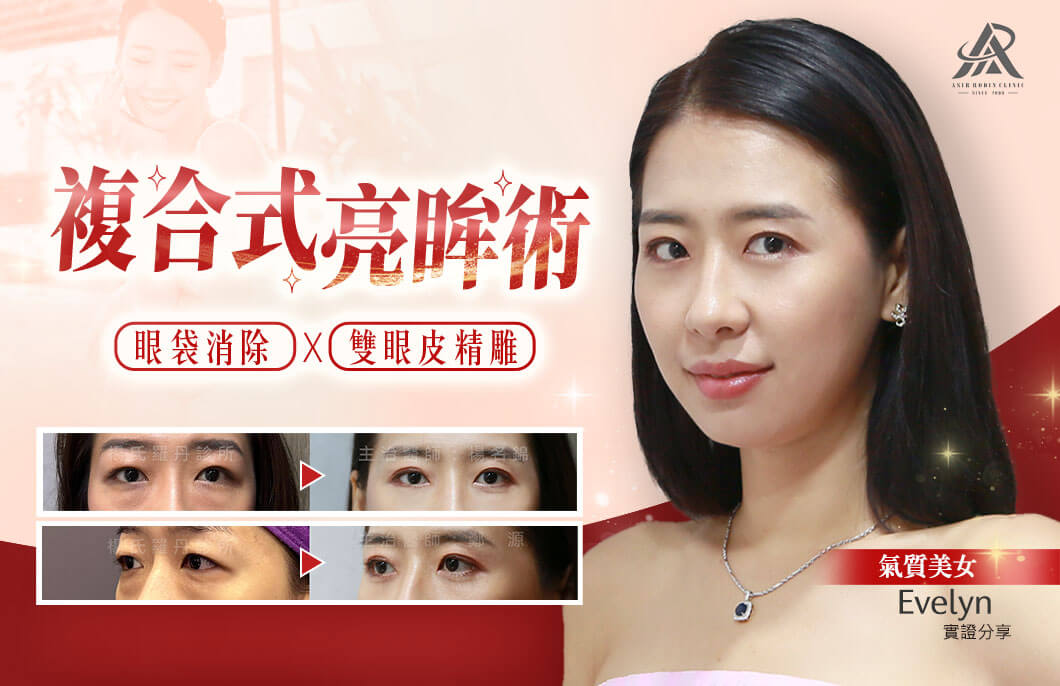 【複合式亮眸術】眼袋消除+雙眼皮精雕，成就雙眼閃耀睛采