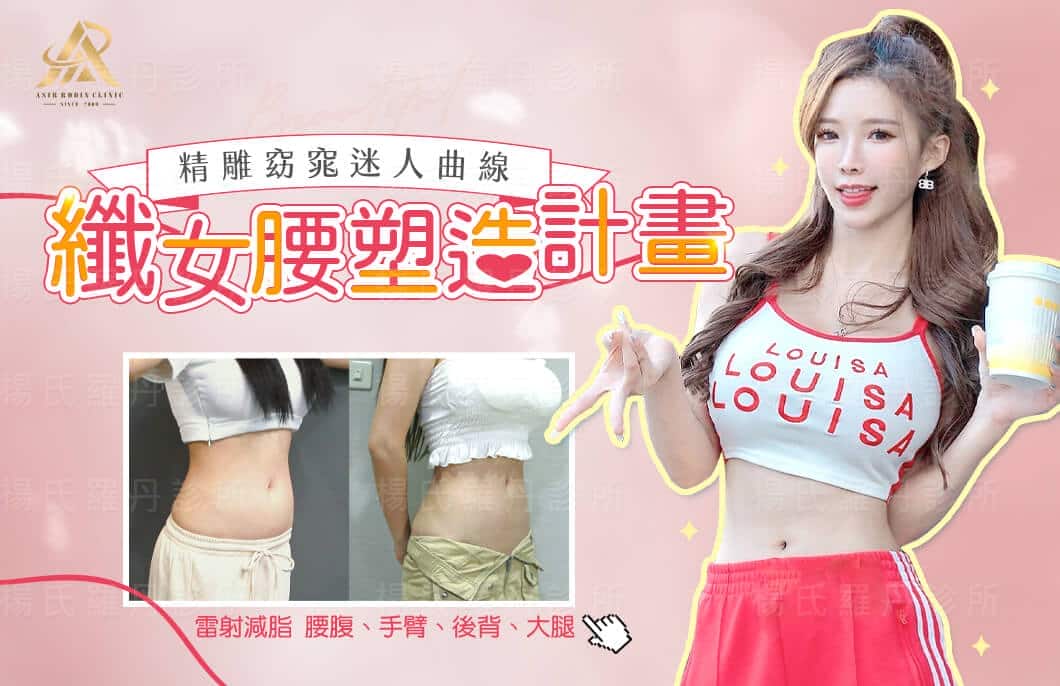 【雷射減脂】星蕾 纖女腰塑造計畫 精雕窈窕迷人曲線