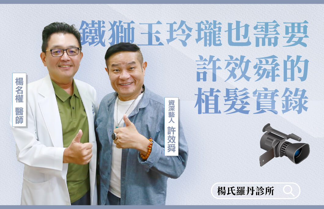 【植髮】鐵獅玉玲瓏也需要—許效舜的植髮實錄