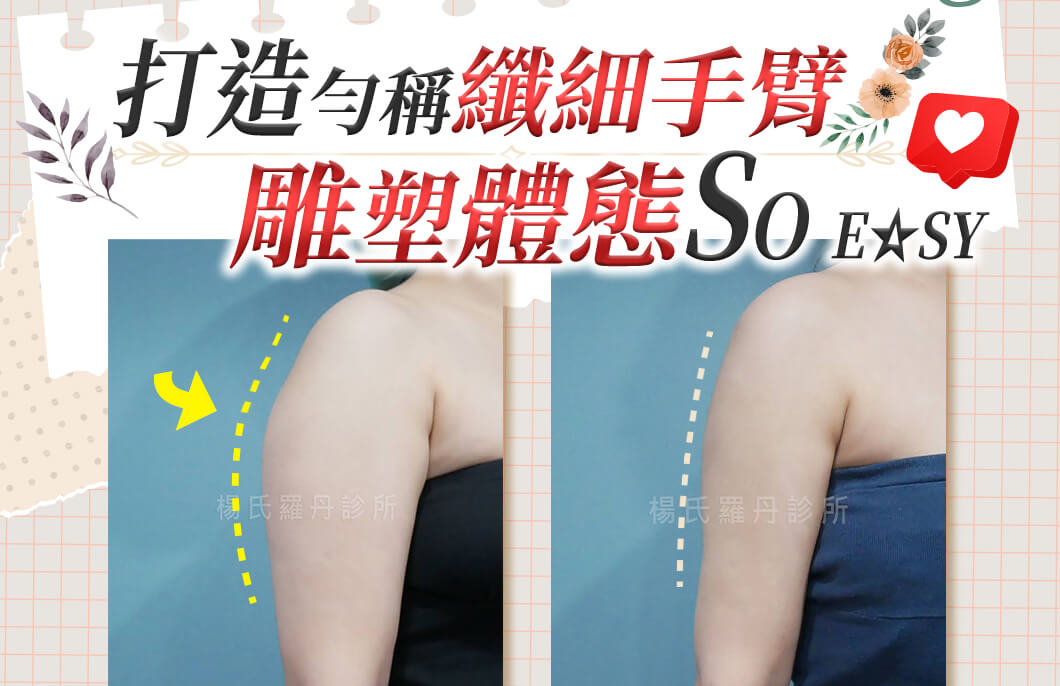 【雷射減脂】打造勻稱纖細手臂，雕塑體態SO EASY
