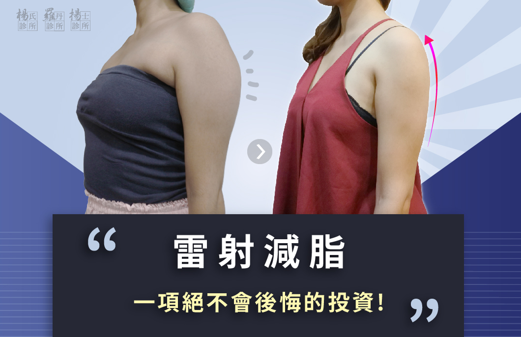 抽脂推薦