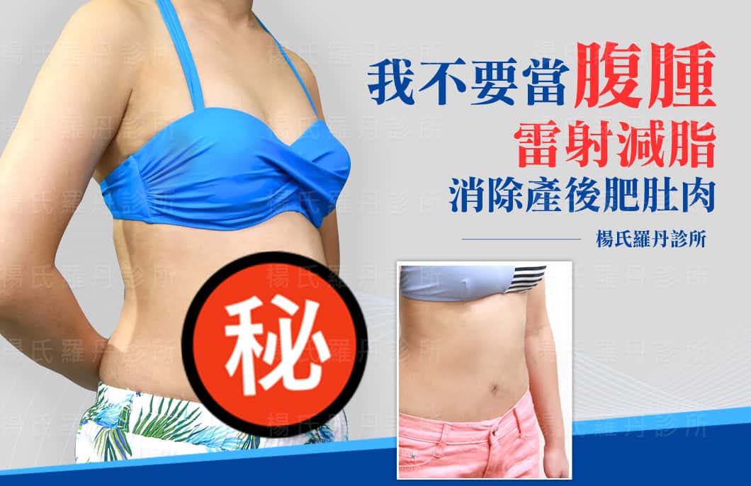 【雷射減脂】我不要當腹腫，雷射減脂消除產後肥肚肉！