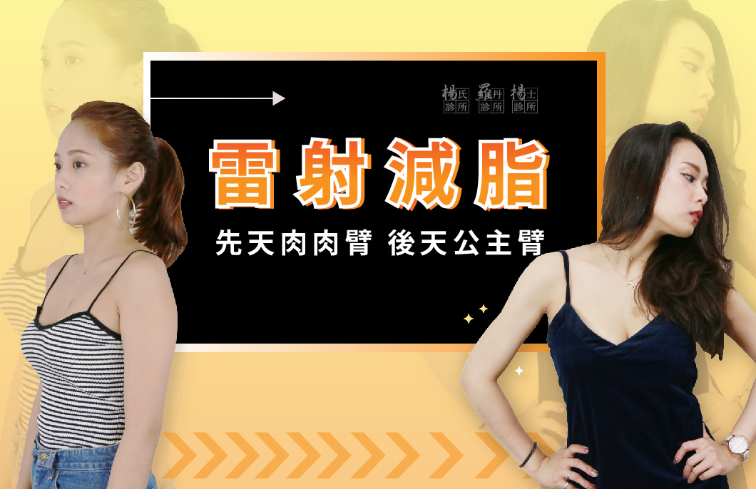 【雷射減脂】先天肉肉臂，後天公主臂！