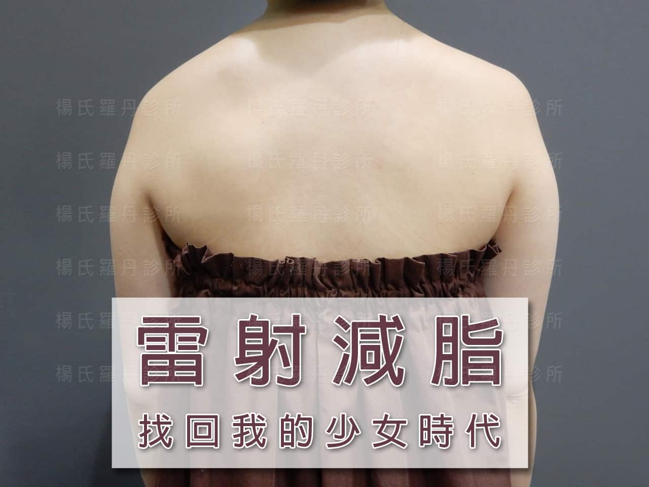 【雷射減脂】找回屬於自己的少女時代！
