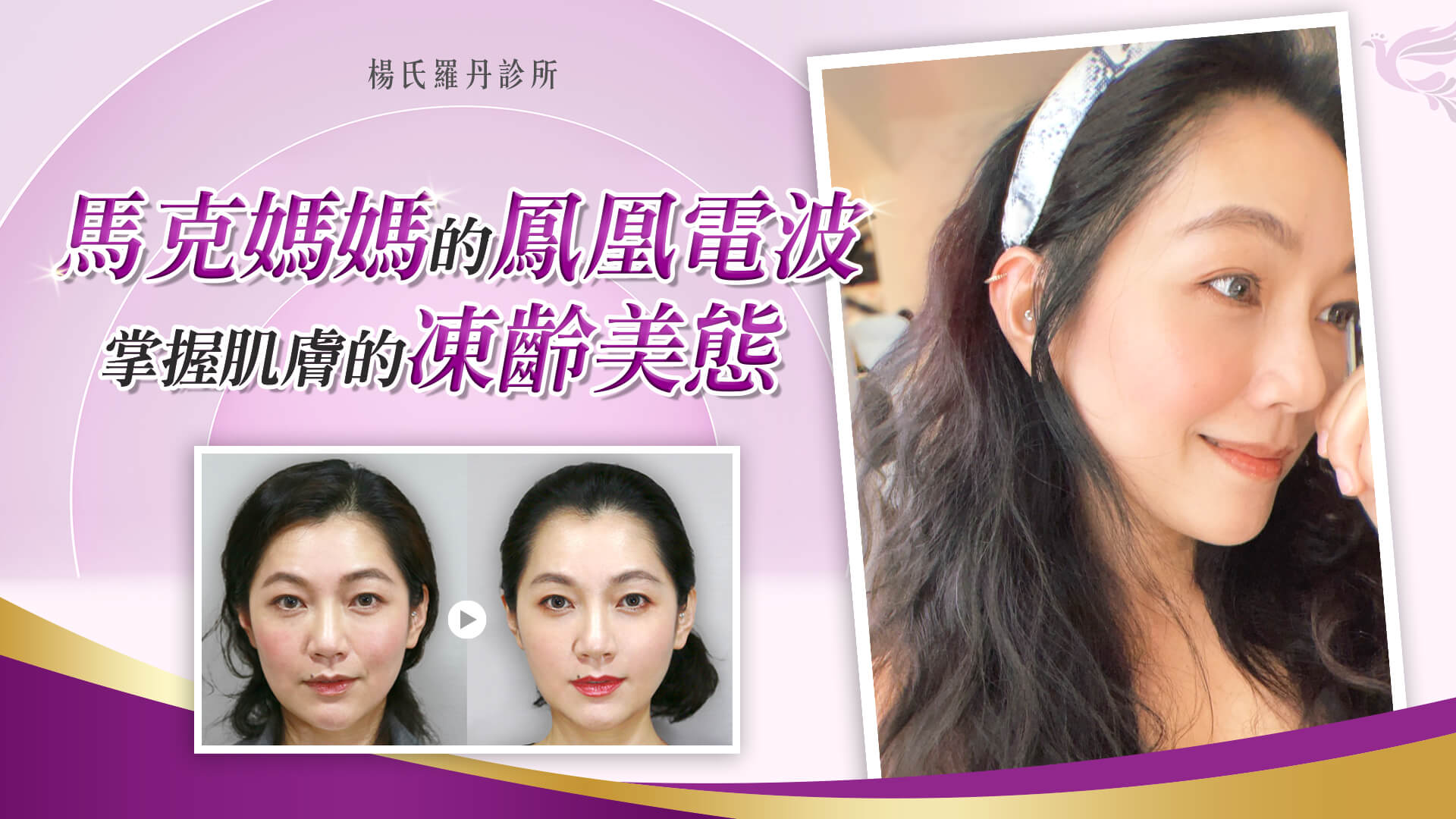 【醫美療程】馬克媽媽的鳳凰電波，掌握肌膚的凍齡美態